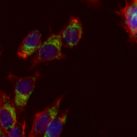 3 - Recombinant Anti-PDK2 Rabbit mAb AP95119