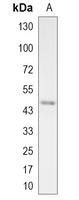 1 - Recombinant Anti-PDK2 Rabbit mAb AP95119