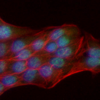 3 - Recombinant Anti-RPA1 Rabbit mAb AP95122
