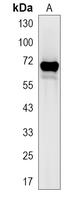 1 - Recombinant Anti-RPA1 Rabbit mAb AP95122