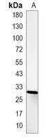 1 - Recombinant Anti-GCLM Rabbit mAb AP95124
