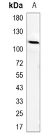 1 - Recombinant Anti-PSD93 Rabbit mAb AP95125