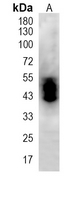 1 - Recombinant Anti-Nogo Rabbit mAb AP95126