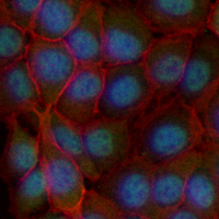 3 - Recombinant Anti-HMGA1 Rabbit mAb AP95129