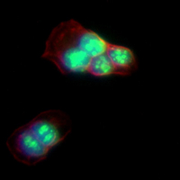 3 - Recombinant Anti-METTL3 Rabbit mAb AP95130
