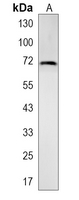 1 - Recombinant Anti-METTL3 Rabbit mAb AP95130