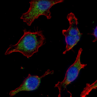 3 - Recombinant Anti-FATP4 Rabbit mAb AP95133