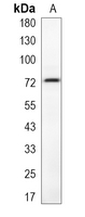 1 - Recombinant Anti-FATP4 Rabbit mAb AP95133