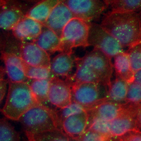 3 - Recombinant Anti-BRAT1 Rabbit mAb AP95135