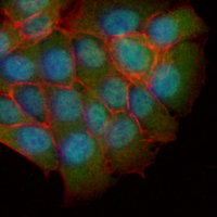 3 - Recombinant Anti-PPP2R5D Rabbit mAb AP95136