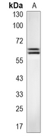 1 - Recombinant Anti-PPP2R5D Rabbit mAb AP95136