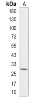 1 - Recombinant Anti-CLIC4 Rabbit mAb AP95138