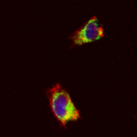 3 - Recombinant Anti-RASEF Rabbit mAb AP95139