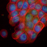 3 - Recombinant Anti-Annexin A7 Rabbit mAb AP95140