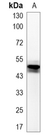 1 - Recombinant Anti-Annexin A7 Rabbit mAb AP95140