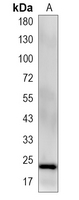 1 - Recombinant Anti-RPS8 Rabbit mAb AP95142