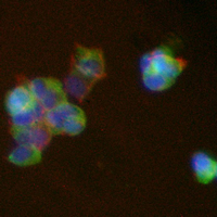 3 - Recombinant Anti-TMEM67 Rabbit mAb AP95143