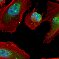 3 - Recombinant Anti-CRABP2 Rabbit mAb AP95144