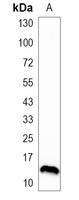 1 - Recombinant Anti-CRABP2 Rabbit mAb AP95144