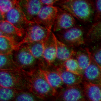 3 - Recombinant Anti-dUTPase Rabbit mAb AP95145