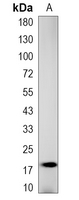 1 - Recombinant Anti-dUTPase Rabbit mAb AP95145