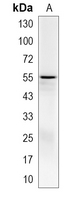 1 - Recombinant Anti-CES1 Rabbit mAb AP95147