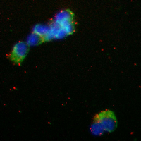 3 - Recombinant Anti-PRKD2 Rabbit mAb AP95149