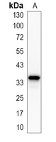 1 - Recombinant Anti-LDHB Rabbit mAb AP95150