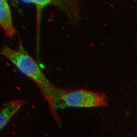 3 - Recombinant Anti-GABBR2 Rabbit mAb AP95151