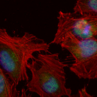 3 - Recombinant Anti-CaMK4 Rabbit mAb AP95152