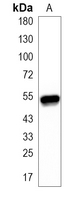 1 - Recombinant Anti-CaMK4 Rabbit mAb AP95152