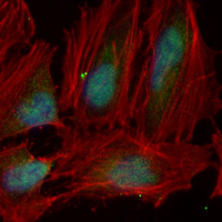 3 - Recombinant Anti-5-Lipoxygenase Rabbit mAb AP95153