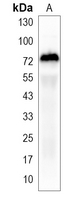 1 - Recombinant Anti-5-Lipoxygenase Rabbit mAb AP95153