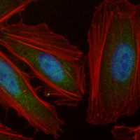 3 - Recombinant Anti-CAD Rabbit mAb AP95154