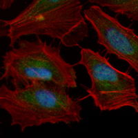 3 - Recombinant Anti-XPO2 Rabbit mAb AP95156