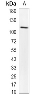 1 - Recombinant Anti-VPS11 Rabbit mAb AP95157