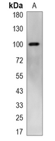 1 - Recombinant Anti-GIT1 Rabbit mAb AP95159
