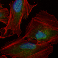 3 - Recombinant Anti-ARP3 Rabbit mAb AP95160