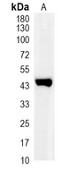 1 - Recombinant Anti-ARP3 Rabbit mAb AP95160