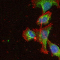 3 - Recombinant Anti-PFKM Rabbit mAb AP95161