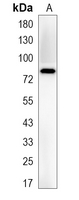 1 - Recombinant Anti-PFKM Rabbit mAb AP95161