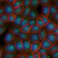 3 - Recombinant Anti-E2F6 Rabbit mAb AP95162