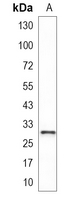 1 - Recombinant Anti-E2F6 Rabbit mAb AP95162