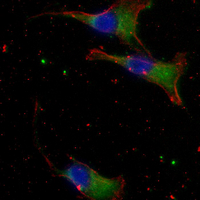 3 - Recombinant Anti-EB3 Rabbit mAb AP95165