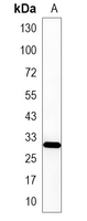 1 - Recombinant Anti-EB3 Rabbit mAb AP95165