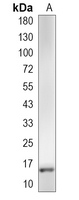 1 - Recombinant Anti-Uteroglobin Rabbit mAb AP95168