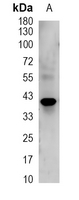 1 - Recombinant Anti-Septin 2 Rabbit mAb AP95169