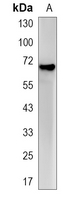 1 - Recombinant Anti-NPR3 Rabbit mAb AP95171