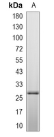 1 - Recombinant Anti-Claudin 11 Rabbit mAb AP95172