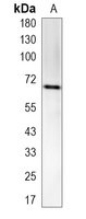 1 - Recombinant Anti-PARP2 Rabbit mAb AP95173